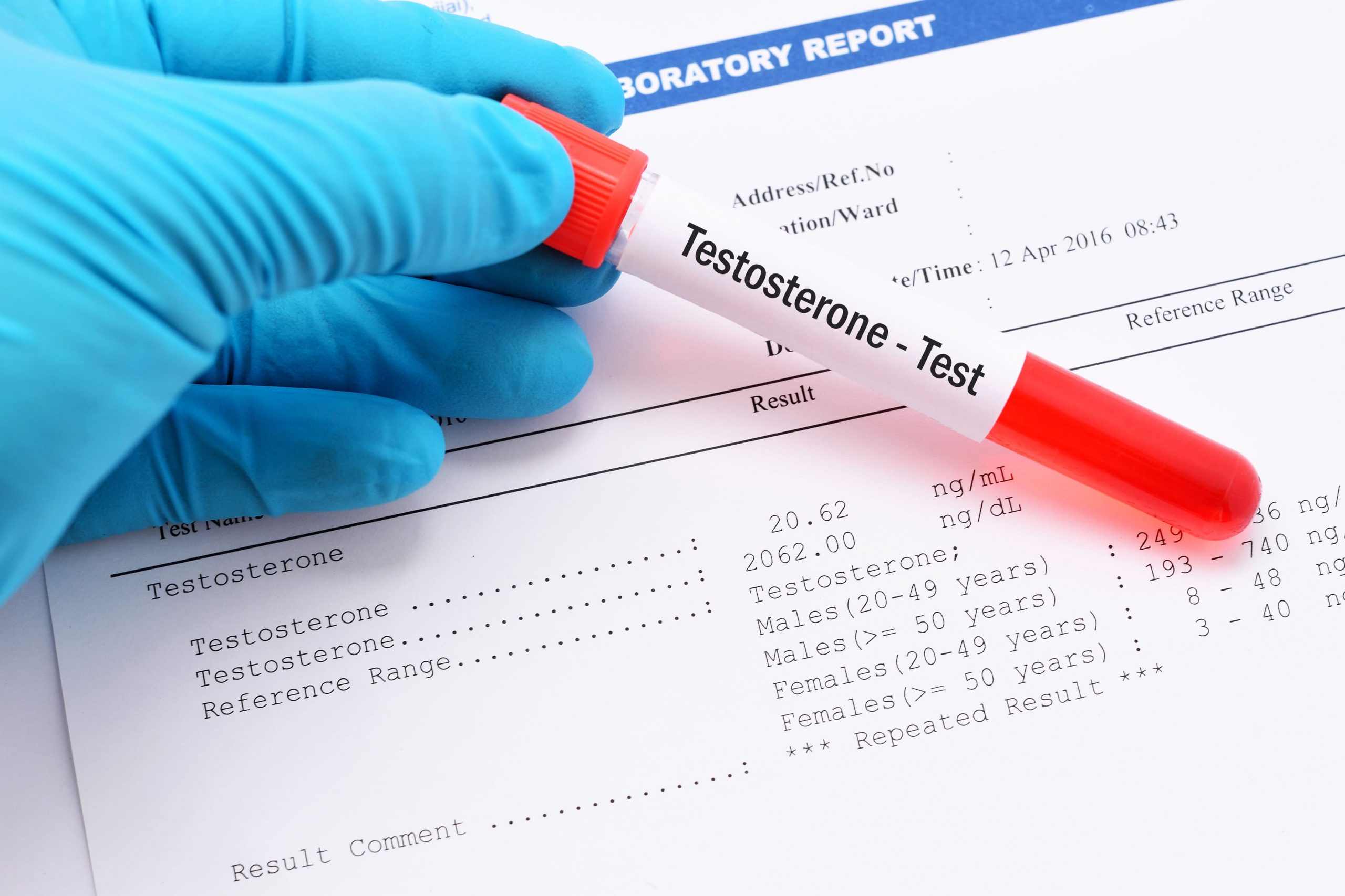 How To Get Tested For Low Testosterone: The Guide to Testosterone Replacement Therapy