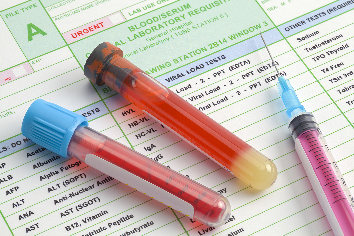 How Often To Get Blood Work On TRT?