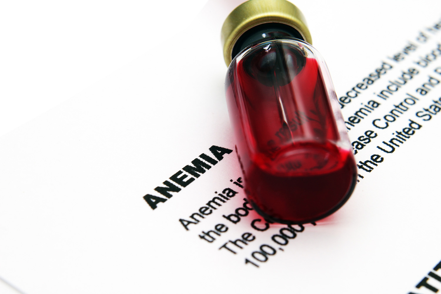 Unexplained Anemia: Testosterone Replacement Therapy Might Help